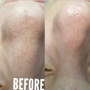 Алла Панечко, Луцк Фото - 10