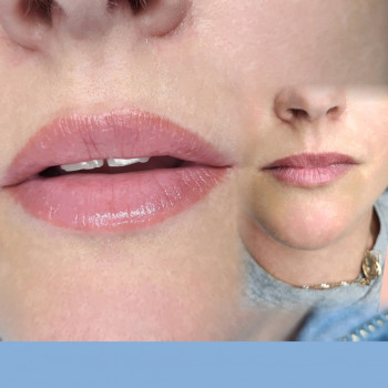 Татуаж губ Борщаговка Киев
                    Мастер перманентного макияжа Светлана Киев