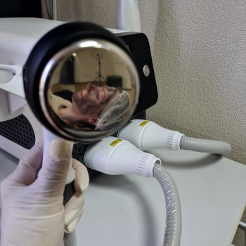 Лазерный карбоновый пилинг Борщаговка Киев
                    Майстер перманентного макіяжу Светлана Київ