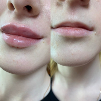 Ирина Чуевская, Львов Фото - 71