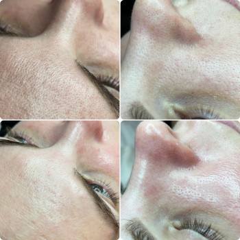 Анастасія Невар, Дніпро Фото - 6