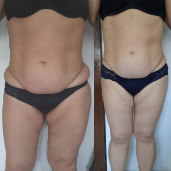 Елена Кнапик, Винница Фото - 6