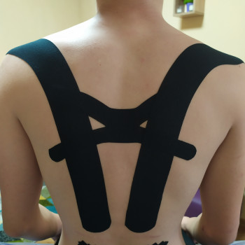 Тейпування постави

   