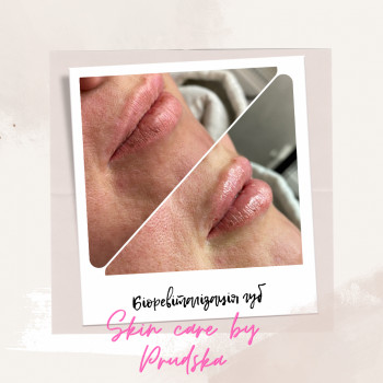 Вера Прудская, Бровары Фото - 23