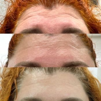 Масаж обличчя 30 хв
                    Масажист Дарья Київ