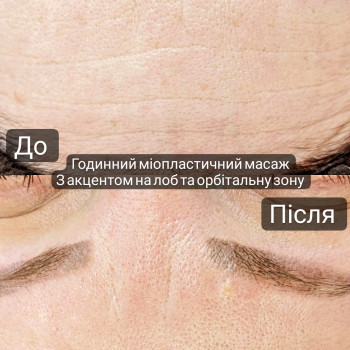 Масаж обличчя 30 хв
                    Масажист Дарья Київ