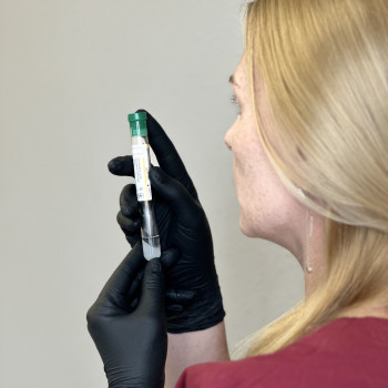 Плазмотерапія
                    Косметолог Людмила Бровари