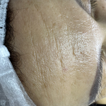 До, фото - косметолог Людмила Ткачук