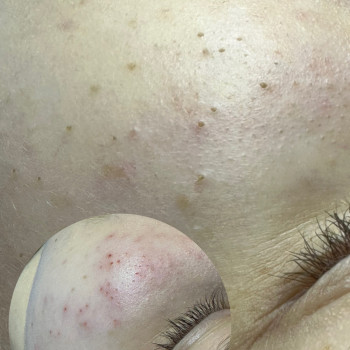 Людмила Ткачук, Бровары Фото - 3