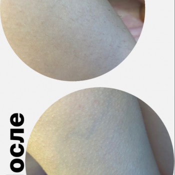 Ніжки до та після