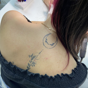 Загоєні 4 місяці