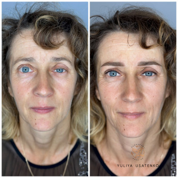 Юлія Усатенко, Запоріжжя Фото - 9