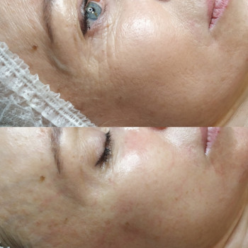 Ферметотерапія
                    Массажист Наталія Черкассы