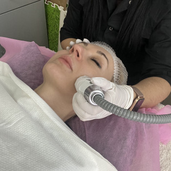 Смас лифтинг HIFU V-MAX
                    Косметолог-эстетист Карина Днепр