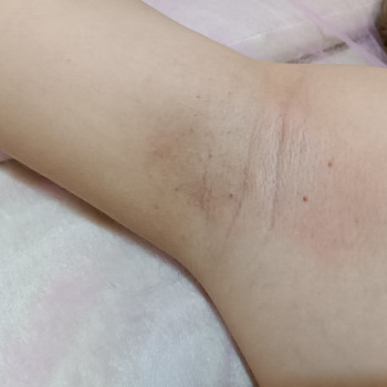 Депіляція
                    Майстер депіляції  Вінниця