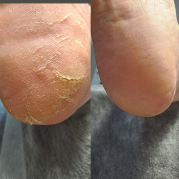 Ярина Кошик, Вишневе Фото - 19