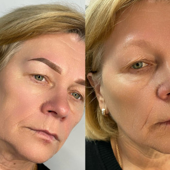 Світлана Паснак, Івано-Франківськ Фото - 41