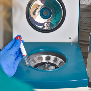 Плазмотерапія