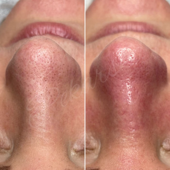 Наталья Косметолог, Дніпро Фото - 1