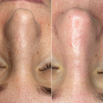 Наталья Косметолог, Дніпро Фото - 4