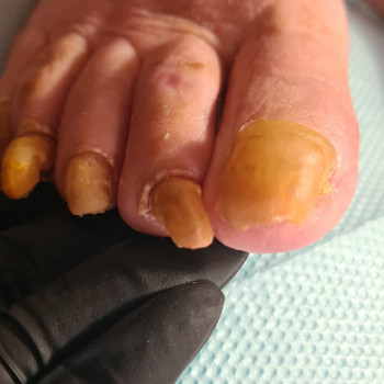 Тетяна Петрова, Чорноморськ Фото - 27