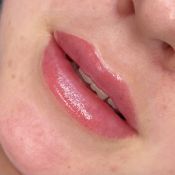 Контурна пластика губ
                    Мастер перманентного макияжа Ольга Житомир