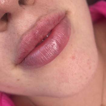 Контурна пластика губ
                    Мастер перманентного макияжа Ольга Житомир