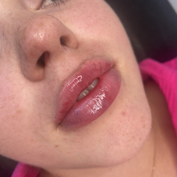 Контурна пластика губ
                    Мастер перманентного макияжа Ольга Житомир