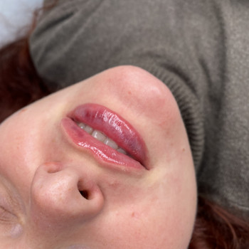 Контурна пластика губ
                    Мастер перманентного макияжа Ольга Житомир