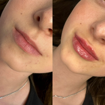 Контурна пластика губ
                    Мастер перманентного макияжа Ольга Житомир