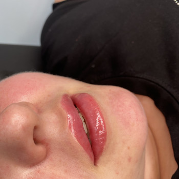 Контурна пластика губ
                    Мастер перманентного макияжа Ольга Житомир