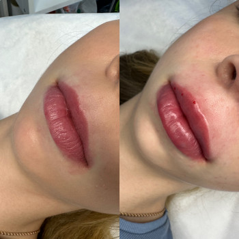 Контурна пластика губ
                    Мастер перманентного макияжа Ольга Житомир