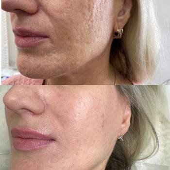 Альона Зелинська, Одеса Фото - 6