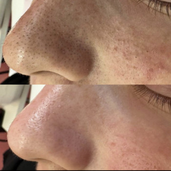 Альона Зелинська, Одеса Фото - 7