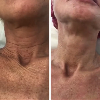 Альона Зелинська, Одеса Фото - 12