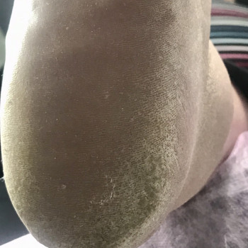 Апаратний медичний педикюр
                    Подолог Марина Одеса