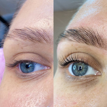 Ламинирование ресниц
                    Бровіст Анна Харків