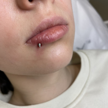 Пірсинг
                    Лікар-косметолог Неля Константиновна Київ