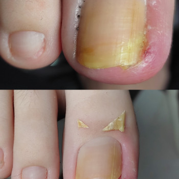 Анна Башмакова, Одеса Фото - 13