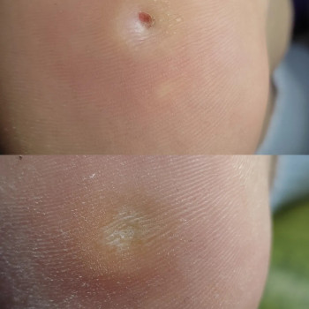 Анна Башмакова, Одеса Фото - 17