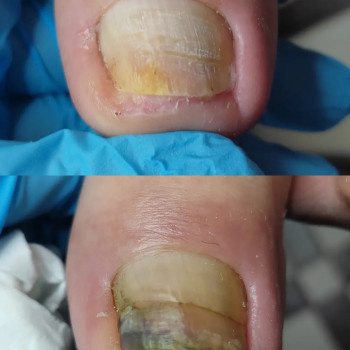 Анна Башмакова, Одеса Фото - 19