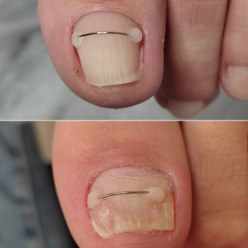 Анна Башмакова, Одеса Фото - 21