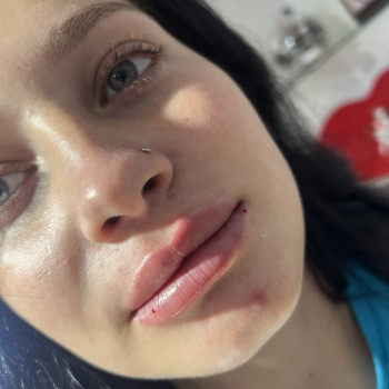 Фото з портфоліо косметолога Олена Савіна (Одеса)