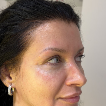 Фото з портфоліо косметолога Олена Савіна (Одеса)