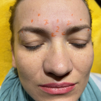 Фото з портфоліо косметолога Олена Савіна (Одеса)