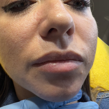 Фото з портфоліо косметолога Олена Савіна (Одеса)