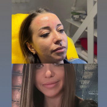 Фото з портфоліо косметолога Олена Савіна (Одеса)