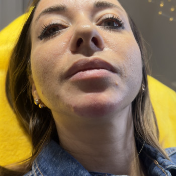 Фото з портфоліо косметолога Олена Савіна (Одеса)