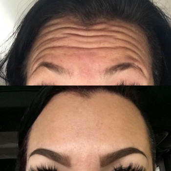 Фото з портфоліо косметолога Олена Савіна (Одеса)