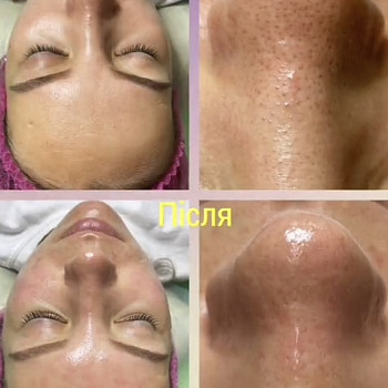 Фото з портфоліо косметолога Олена Савіна (Одеса)